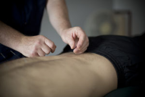 Acupuncture for Lower Back Pain Steve Coster Acupuncture Southend